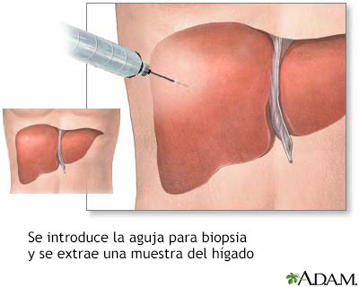Cultivo de tejido hepático - Miniatura de ilustración
              