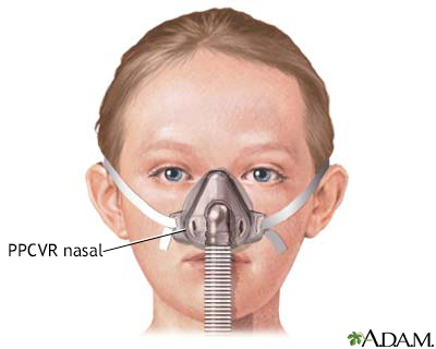 HIE Multimedia - Tratamiento presión en las vías respiratorias