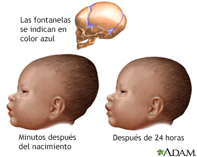 Amoldamiento de cabeza del recién nacido - Miniatura de ilustración
              