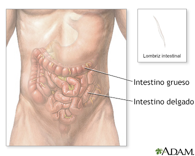 Lombrices intestinales - Miniatura de ilustración
              