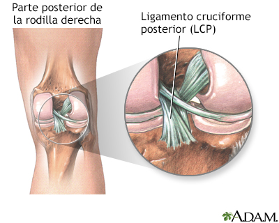 Ligamento cruciforme posterior de la rodilla - Miniatura de ilustración
              