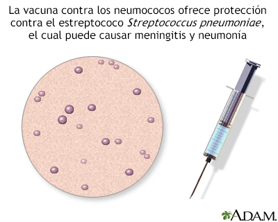 Vacuna antineumocócica - Miniatura de ilustración
              