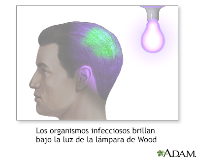 Iluminación de lámpara de Wood