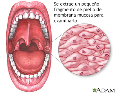 Biopsia de mucosa