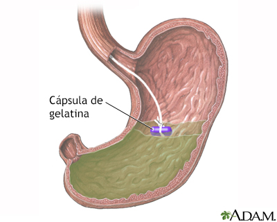 Cápsula de gelatina en el estómago - Miniatura de ilustración
              
