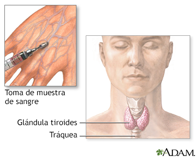 Examen de función tiroidea - Miniatura de ilustración
              