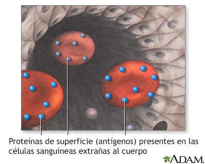 Proteínas superficiales que causan rechazo - Miniatura de ilustración
              
