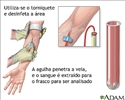 Exame de sangue