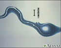 Organismo da doença de Lyme, Borrelia burgdorferi