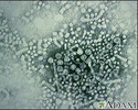 Vírus da hepatite B
