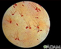 Organismo Salmonella typhi