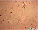 Organismo Yersinia enterocolitica 