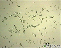 Organismo Campylobacter jejuni