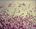 Organismo Clostridium difficile