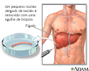 Biópsia do fígado
