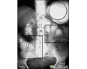 Íleo - raio X de distensão estomacal e intestinal