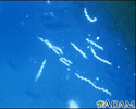 Doença de Lyme - Organismo Borrelia burgdorferi