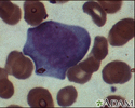 Mononucleose, fotomicrografia das células