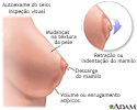 Autoexame da mama
