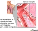 Bronquiolite