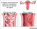 Causas de dor durante o ato sexual
