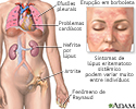 Lúpus eritematoso sistêmico