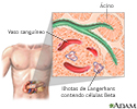 Ilhotas de Langerhans