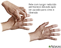 Turgor da pele