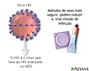 HIV