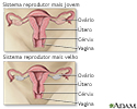 Menopausa