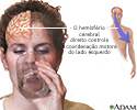 Hemisfério cerebral direito - função