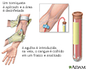 Exame de sangue PSA