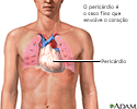 Pericárdio