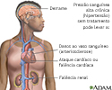 Hipertensão não tratada
