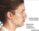Facelift - série