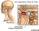 Causes of secondary headache