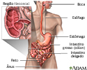 Doença de Crohn - áreas afetadas