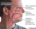 Sintomas das alergias