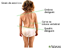 Sinais de escoliose