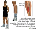 Canelite