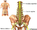 Cauda equina