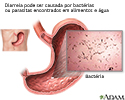 Diarreia