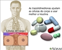 Tiazolidinedionas