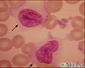 Mononucleose, fotomicrografia da célula