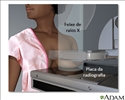 Mamografia
