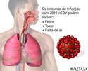 COVID-19