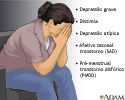 Formas de depressão