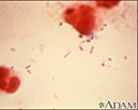 Organismo Haemophilus influenza