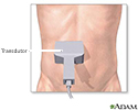 Ultrassom abdominal