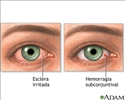 Olhos vermelhos